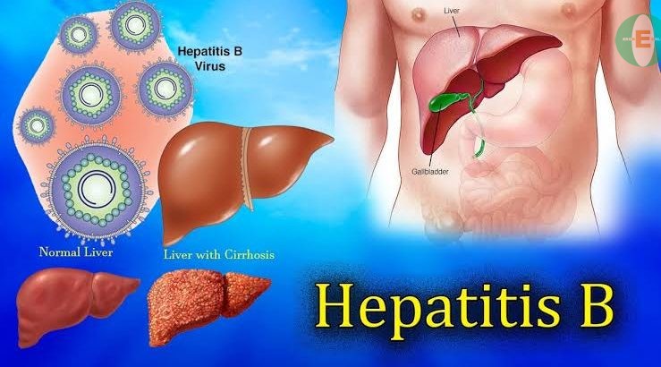 Total Cure For Hepatitis
